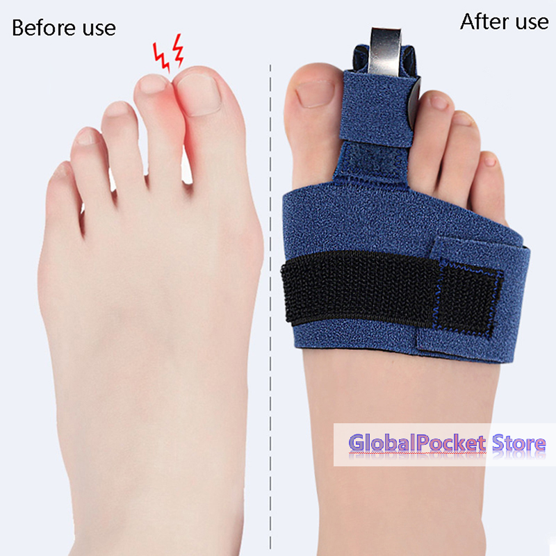 1Pcs Toe Corrector Toe Fractur - Ankle Brace Sock incelemesi ve fiyatı